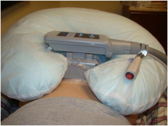 LMYYDES Mini Cool Sculpting Cryolipolyse Minceur Machine 3in1 Portable